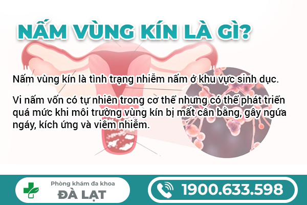 Hình ảnh minh họa